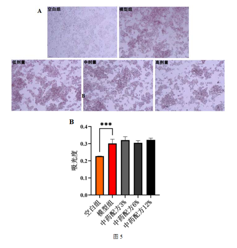 中药配方对 FFA 诱导的 HepG2 细胞油红 ◎ 染色图;A 是染色结果图;B 是中药配方油红 0染色吸光度结果图;.png