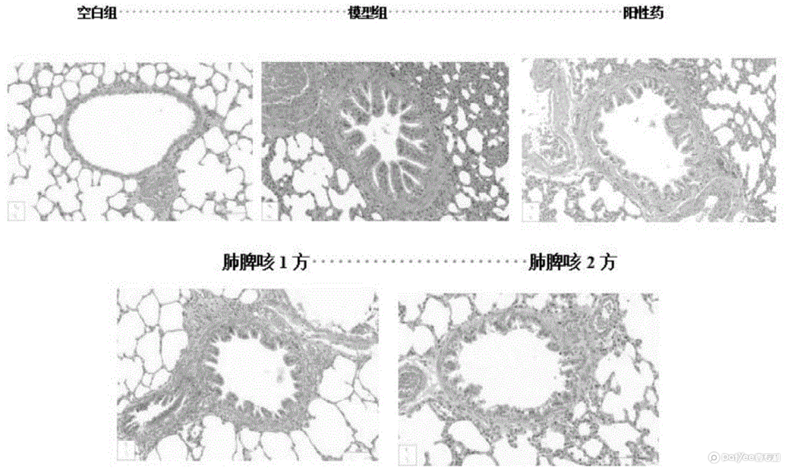 的各组大鼠肺组织形态学变化示意图.GIF.png
